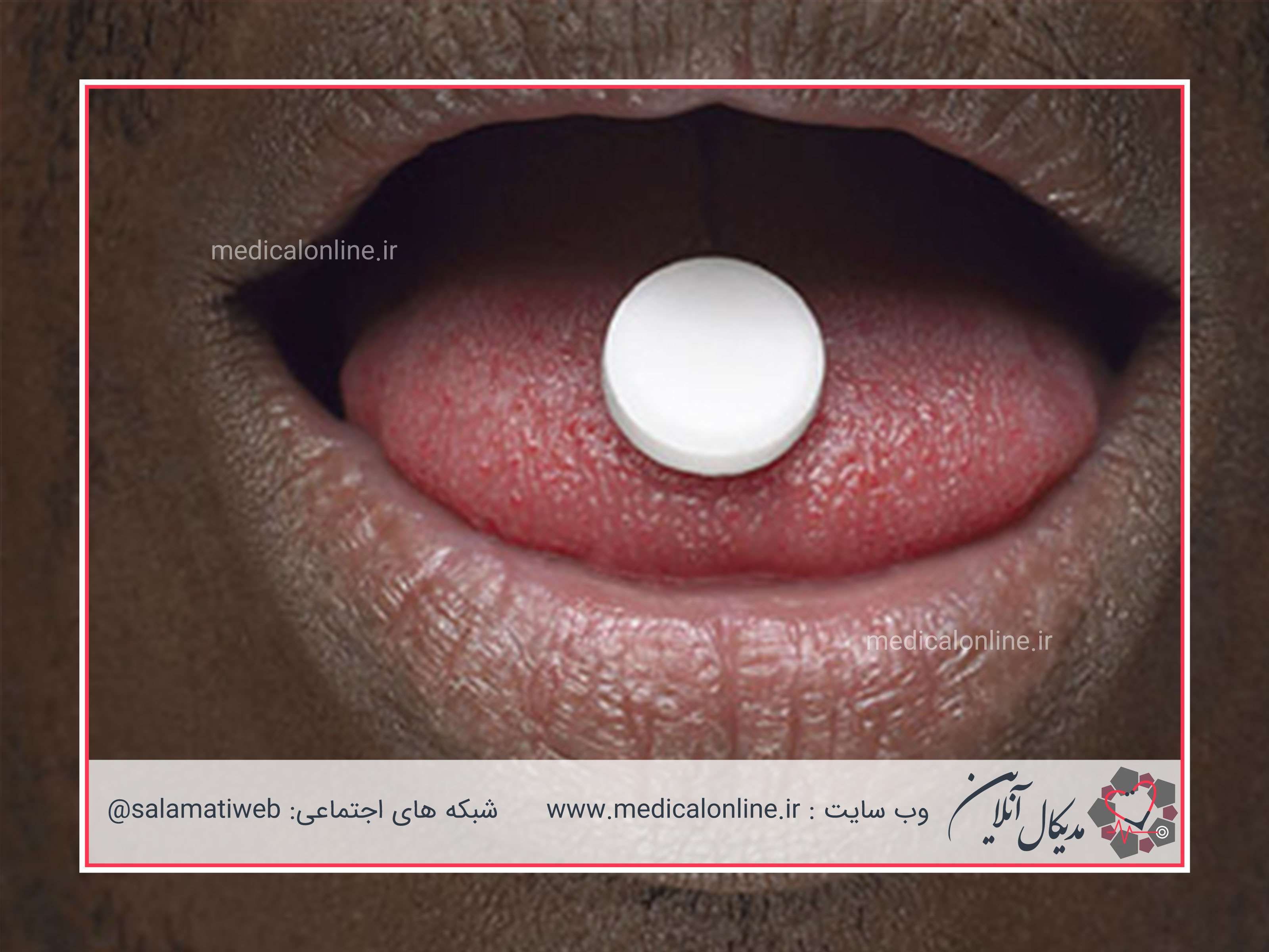 داروهایی که باعث خشکی دهان میشوند